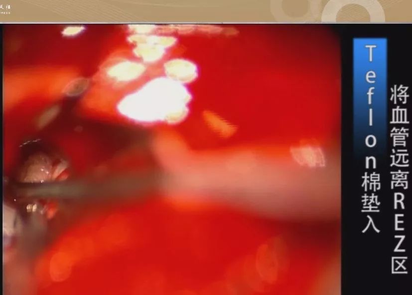 国产一级精品高清一级毛片